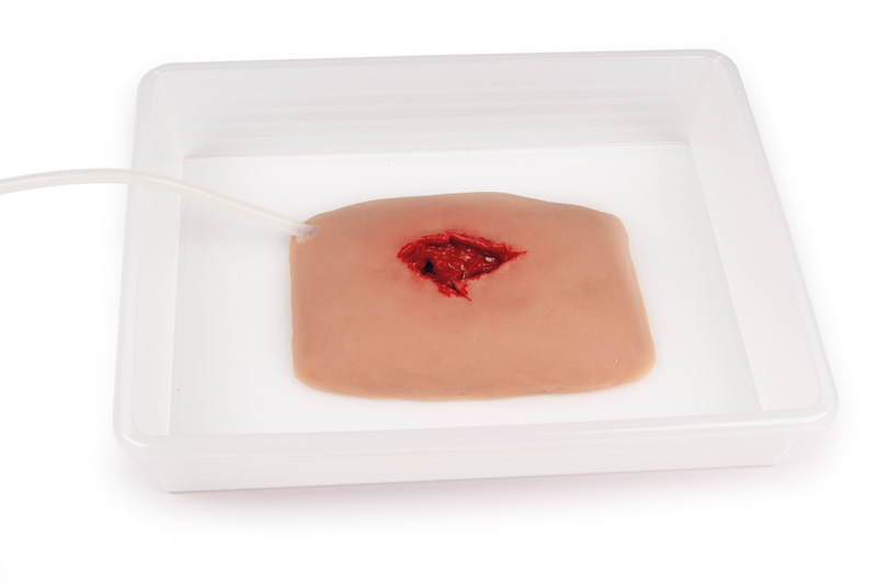 Wundmoulage Wound Packing Wundmoulage Wound Packing