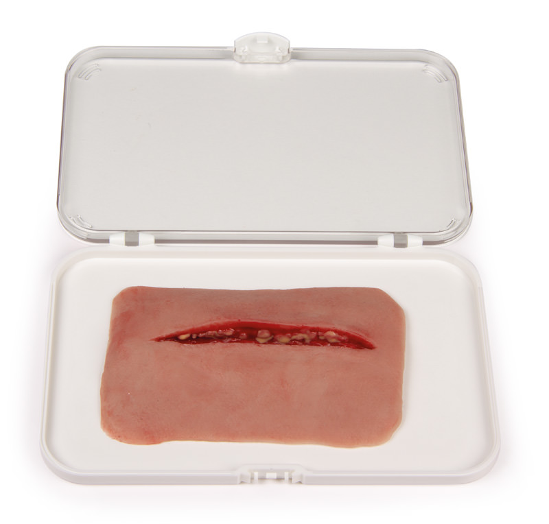 Schnittwunde Schnittwunde