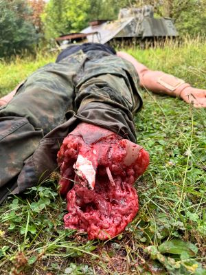 Amputationsstumpf rechts für Combat Carl